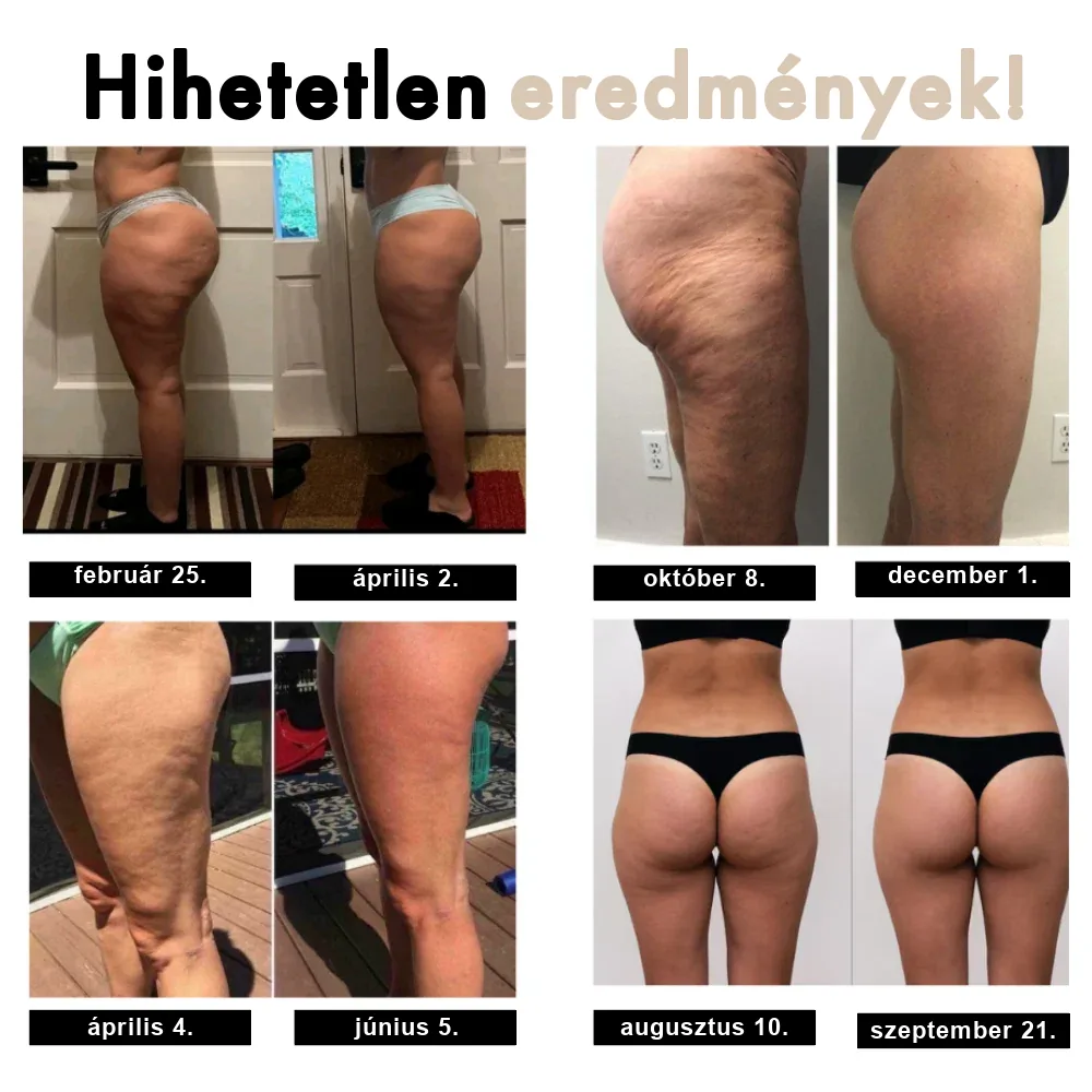 Modelira 3D kompressziós legging